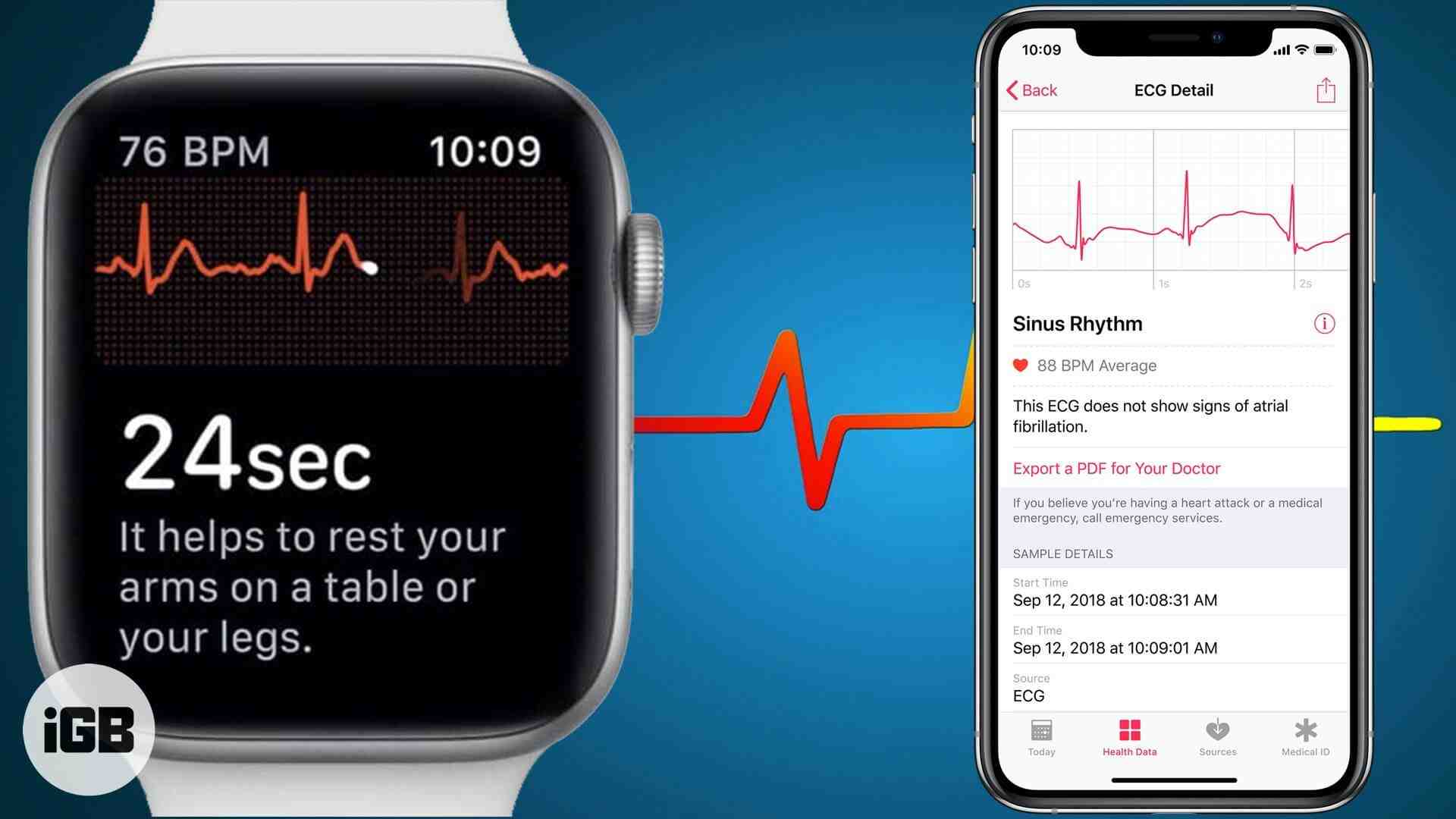 How accurate is the ECG on Apple Watch?